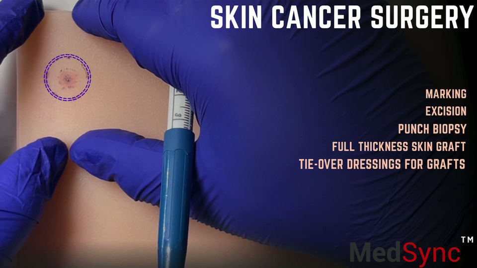 Course: Skin Cancer Surgery